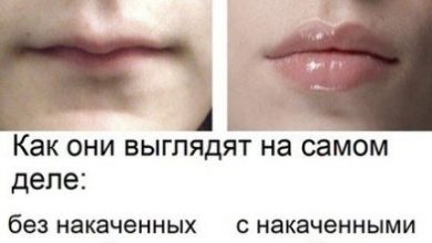 А как вы относитесь к увеличению губ?